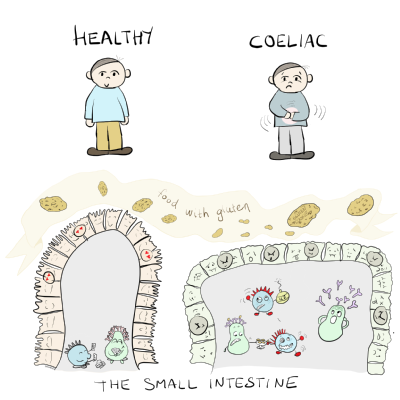 HLA molecules